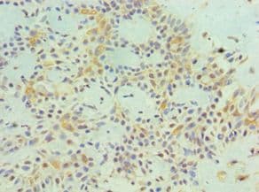 Polyclonal Rabbit anti-Human MAGEA1 / MAGE 1 Antibody (aa1-309, IHC)