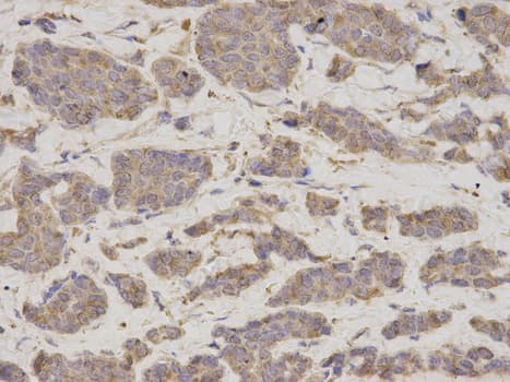 IHC-plus™ GDI1 Antibody