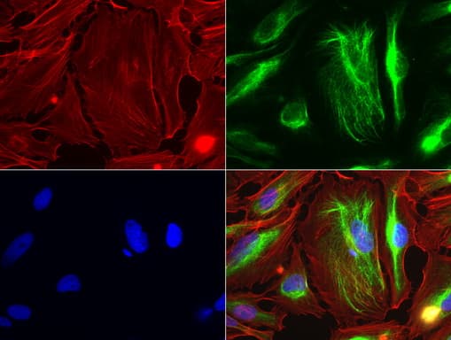 Vimentin Antibody (aa210-466, clone UMAB159)