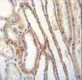 Polyclonal Rabbit anti-Human MYO3B Antibody (aa1086-1116, IHC, WB)
