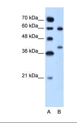 ARG1 / Arginase 1 Antibody (aa101-150)