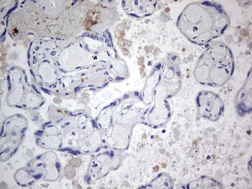 TACC2 Antibody (aa727-1026, clone OTI3C4)