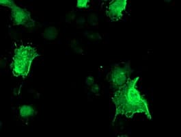 Monoclonal Mouse anti-Human ARH / LDLRAP1 Antibody (clone OTI7H10, IF, WB)
