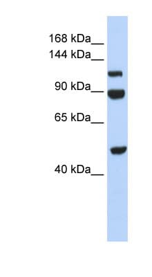 Polyclonal Rabbit anti-Human NAA16 / NARG1L Antibody (aa684-733, WB)