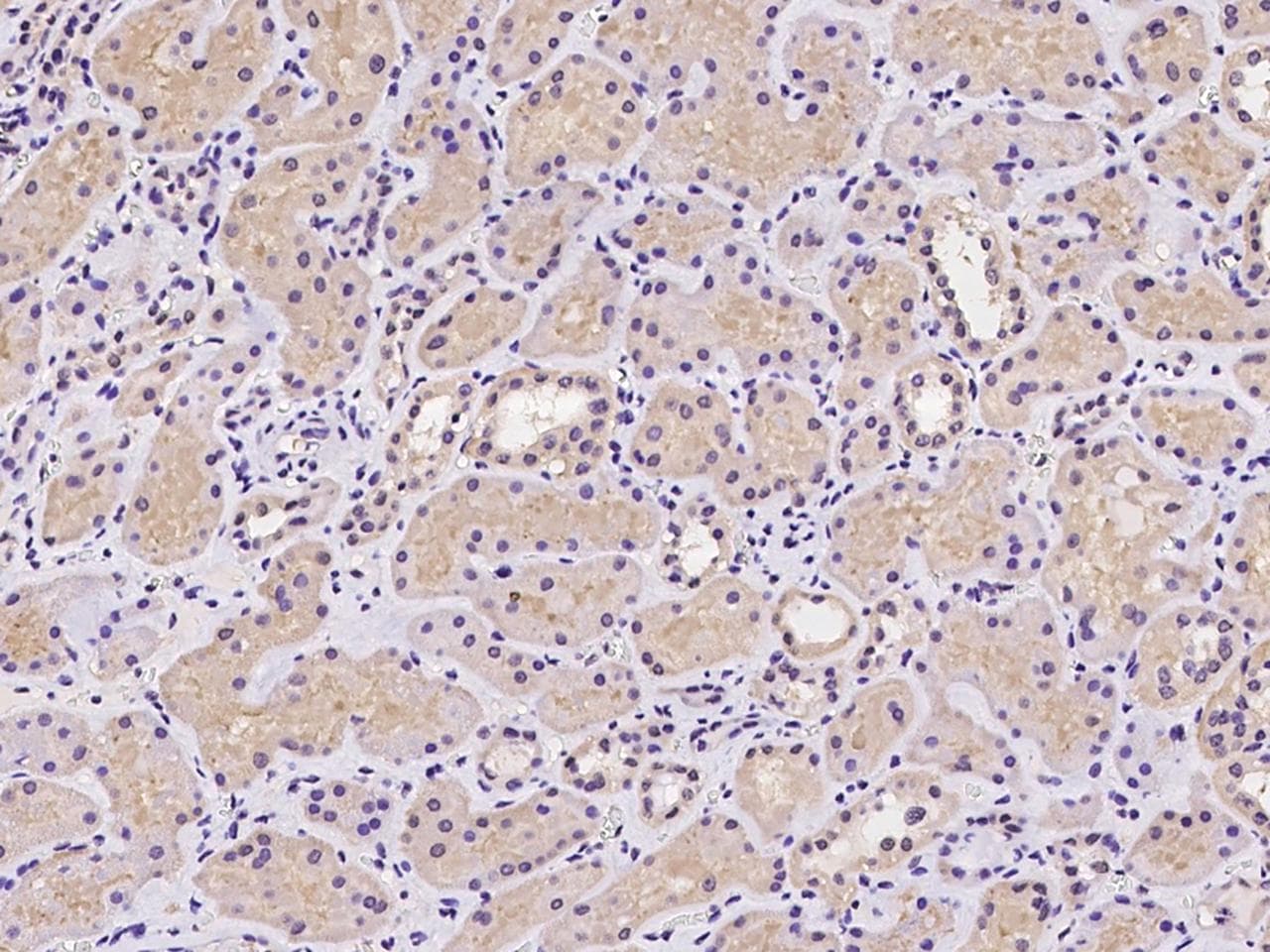Polyclonal Rabbit anti-Human CDKN2AIPNL Antibody (IHC)