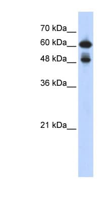 RELA / NFKB p65 Antibody (C-Terminus)