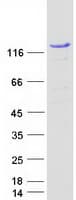 Human STAT2 Protein (Recombinant Myc-DDK (Flag))