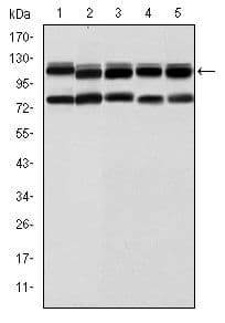 Monoclonal Mouse anti-Human BMPR2 Antibody (clone 1F12, IHC, WB)