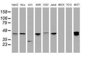 PRR11 Antibody (aa125-360, clone OTI1A4, Carrier-free)