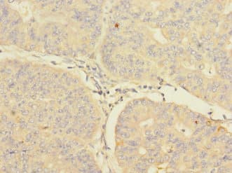 CIR1 Antibody