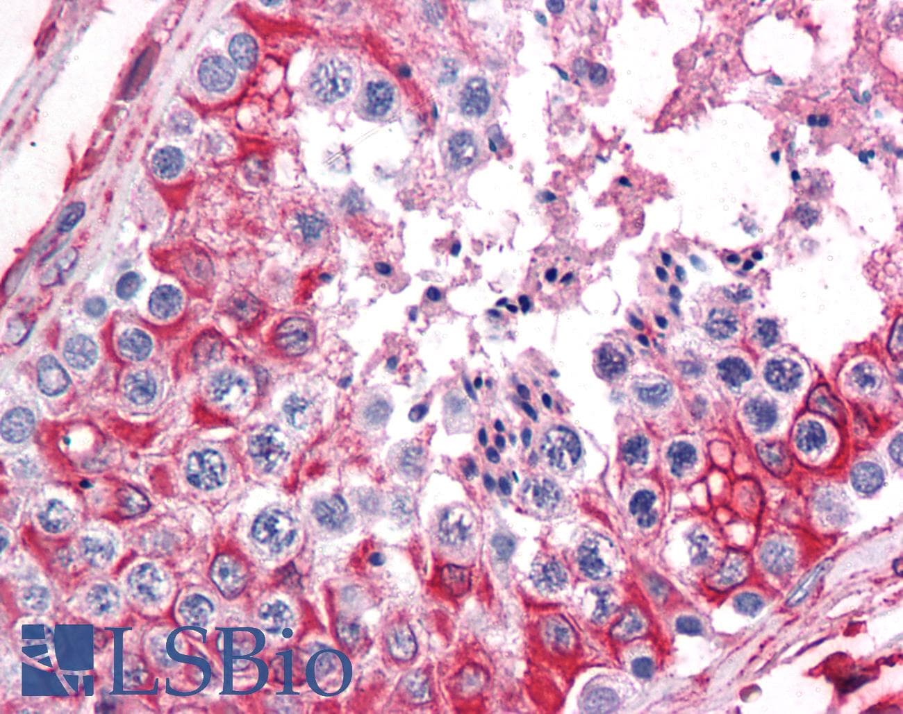 IHC-plus™ SHMT / SHMT1 Antibody (clone 4F9)