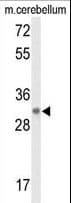 Polyclonal Rabbit anti-Human DAGLB Antibody (aa491-518, WB)