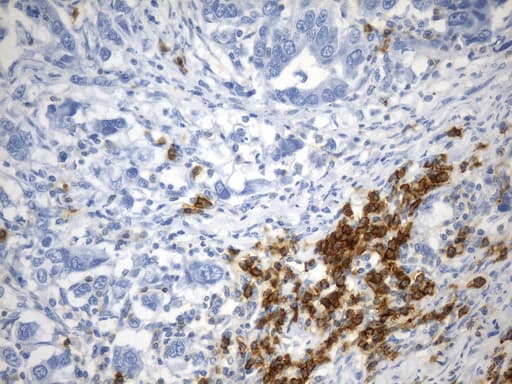 CD38 Antibody (aa43-300, clone UMAB263)