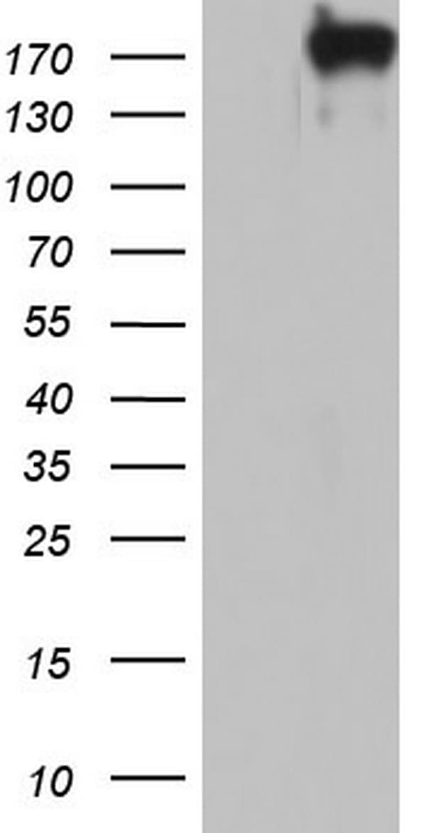 VWF / Von Willebrand Factor Antibody (aa764-1263, clone OTI8G8)