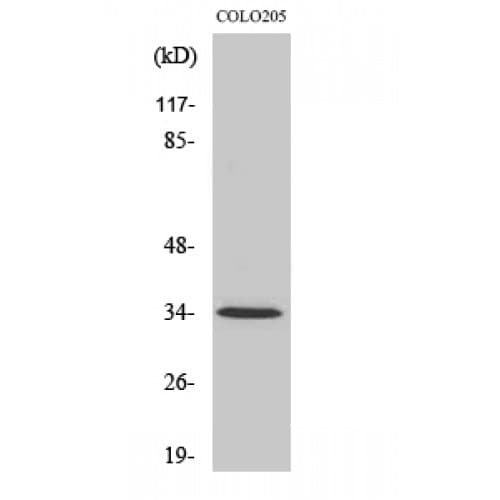 JCG1 / OR5P3 Antibody (30-110 aa, Internal)