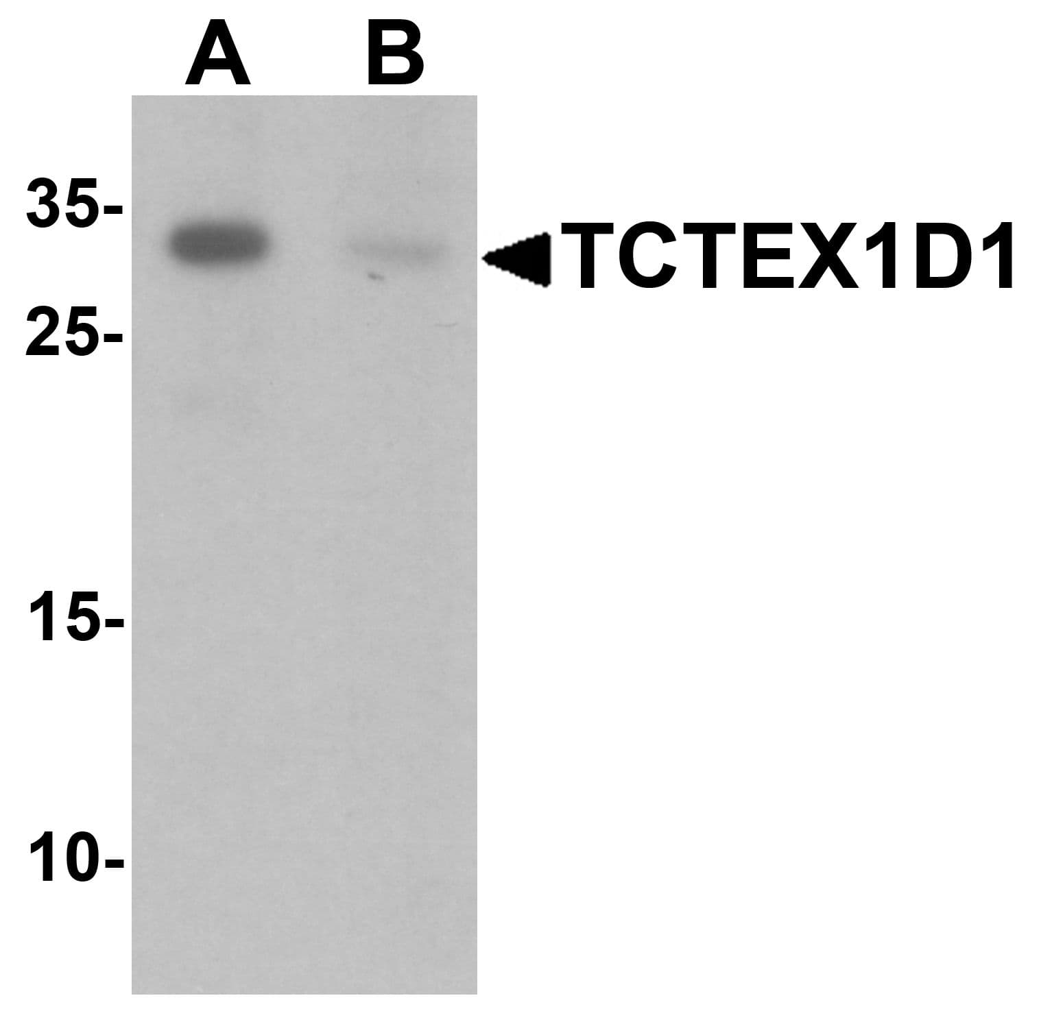 IHC-plus™ TCTEX1D1 Antibody