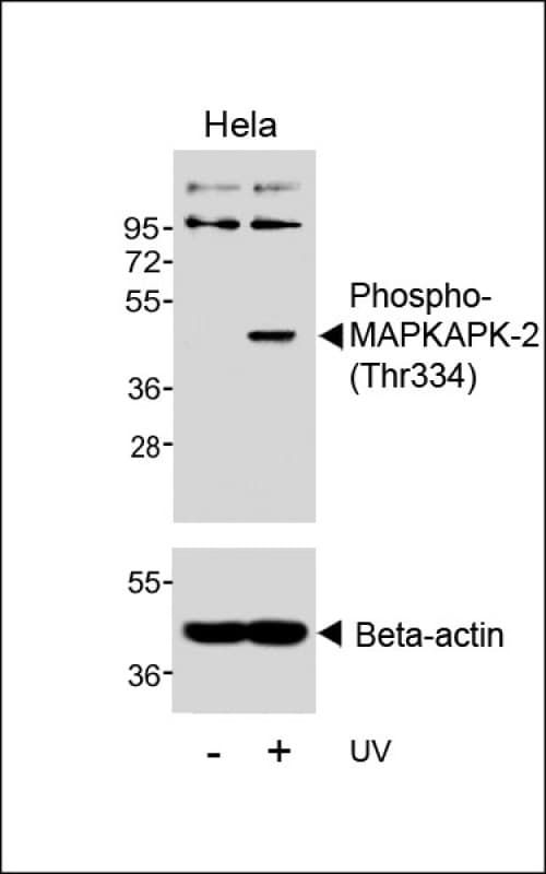 Polyclonal Rabbit anti-Human MAPKAPK2 / MAPKAP Kinase 2 Antibody (phospho-Thr334, WB)