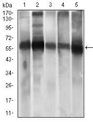 ALDH2 Antibody (aa317-517, clone 4G6A3)