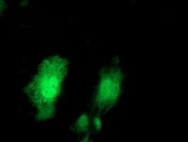 PRMT2 Antibody (clone OTI5E11)