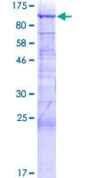 Human Gametogenetin / GGN Protein (Recombinant GST)