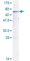 Human HSD2 / HSD11B2 Protein (Recombinant GST)