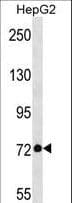 DDX21 Antibody (aa128-156)
