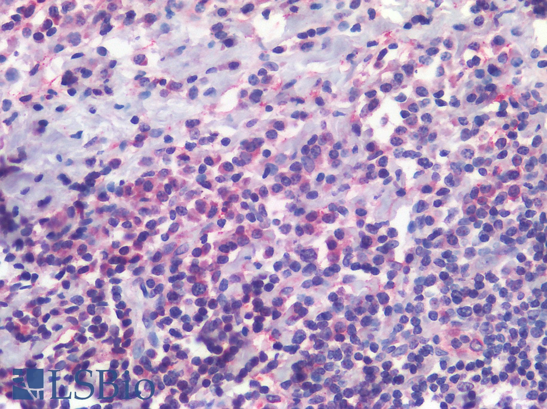 PathPlus™ ITGAX / CD11c Antibody (Internal)