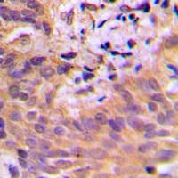 Polyclonal Rabbit anti-Human CDKL2 Antibody (Internal, IHC, WB)