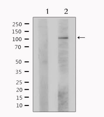 Polyclonal Rabbit anti-Human LIG4 / DNA Ligase IV Antibody (IHC, IF, WB)