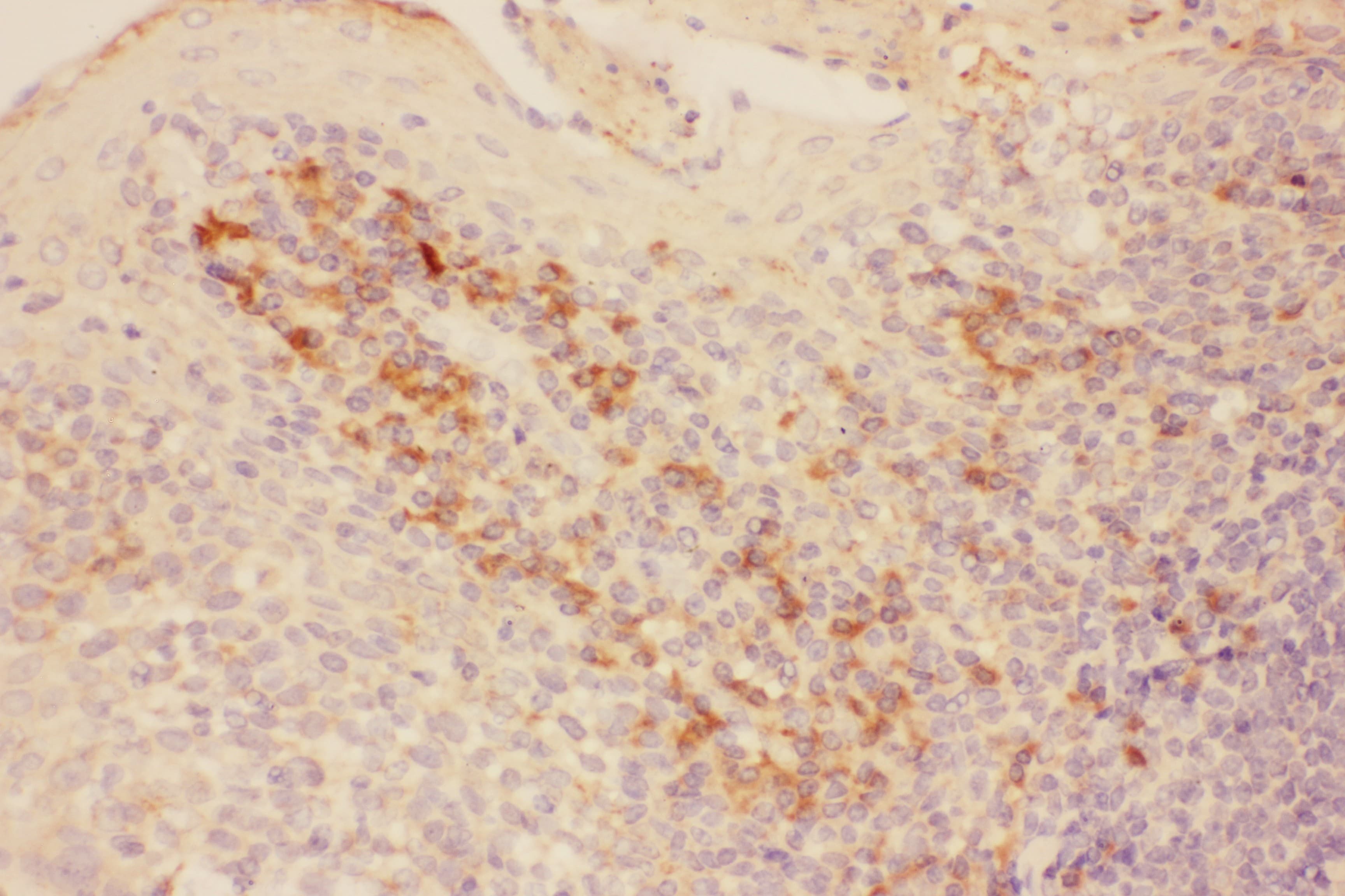 Polyclonal Rabbit anti-Human ITGB1 / Integrin Beta 1 / CD29 Antibody (aa527-728, IHC, WB)