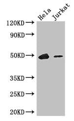 IKZF1 / IKAROS Antibody