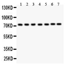 GCLC Antibody (aa437-637)