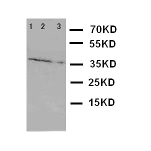GZMA / Granzyme A Antibody (aa175-190)