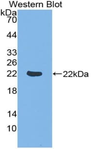 DR1 / NC2 Antibody (aa2-170)