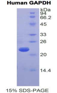 Human GAPDH Protein (Recombinant His)