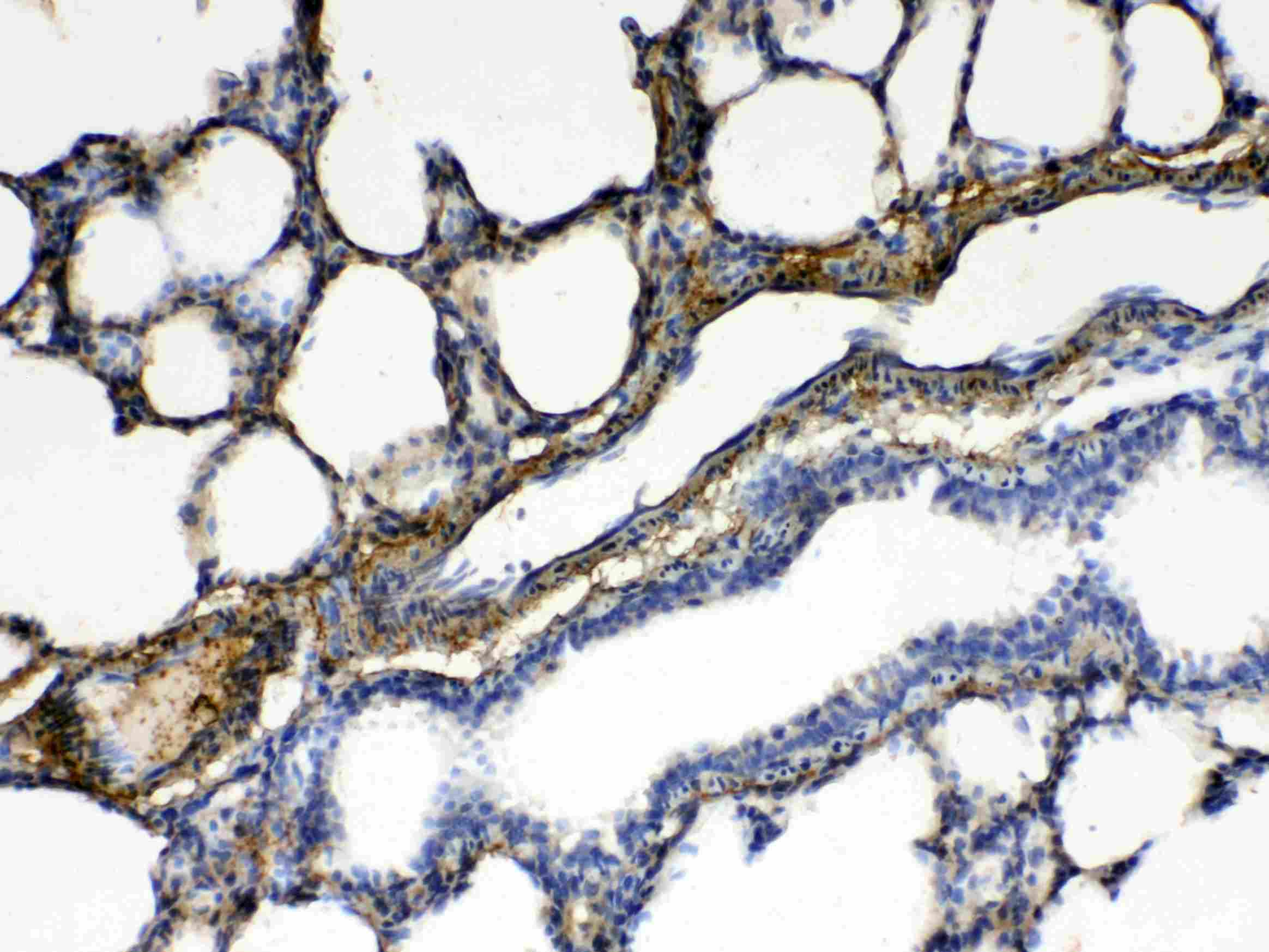 PPP1R14A / CPI-17 Antibody