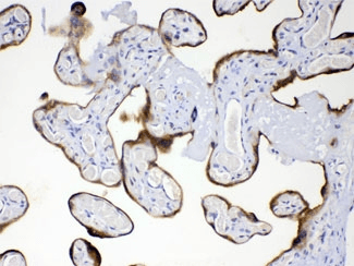 GP78 / AMFR Antibody