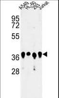 ARGLU1 Antibody (aa48-74)