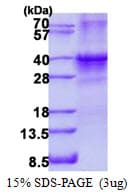 Human SIX1 Protein (Recombinant His)