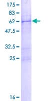Human COL23A1 / Collagen XXIII Protein (Recombinant GST)