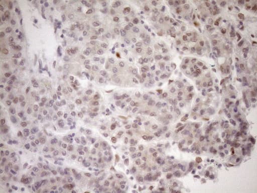 MED15 / ARC105 Antibody (aa393-679, clone OTI1C11)