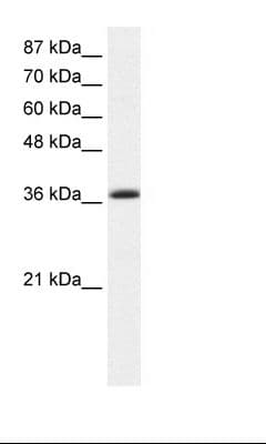 EKLF / KLF1 Antibody (aa188-237)
