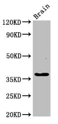 Polyclonal Rabbit anti-Human GHITM Antibody (IHC, WB)