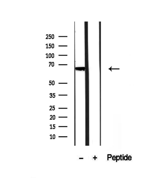 Polyclonal Rabbit anti-Human PHF19 Antibody (IHC, WB)