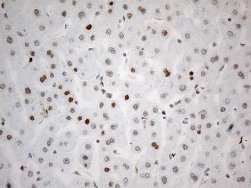 Monoclonal Mouse anti-Human PCNA Antibody (clone UMAB278, Carrier-free, IHC)