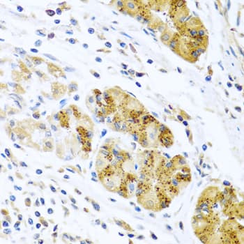 CCL8 / MCP2 Antibody