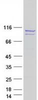 Human OPA1 Protein (Recombinant Myc-DDK (Flag))