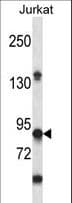 Polyclonal Rabbit anti-Human PTPRN / IA-2 Antibody (aa288-316, WB)