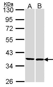 Polyclonal Rabbit anti-Human FAM50A Antibody (aa149-339, WB)