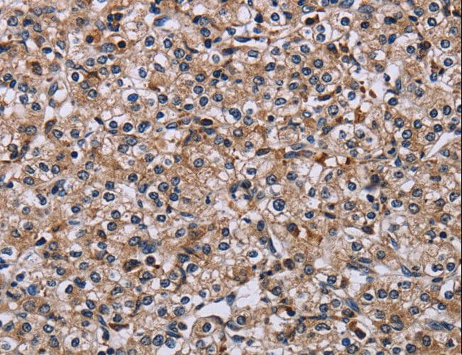 IPO4 Antibody